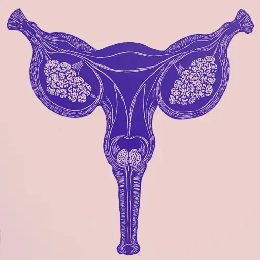 How to know a stone is leaving the bladder and what to do